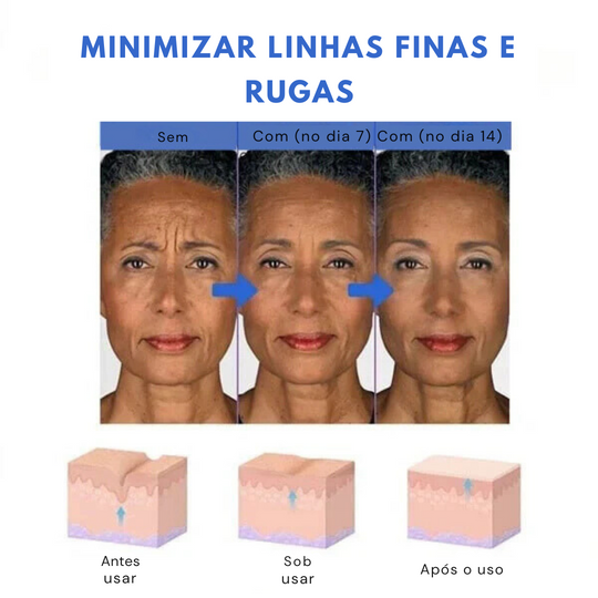 SkinLift™ Sérum Facial Botox